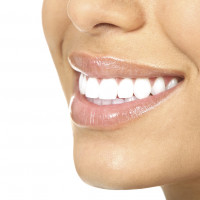 DeJesus Dental Teeth Whitening Connecticut
